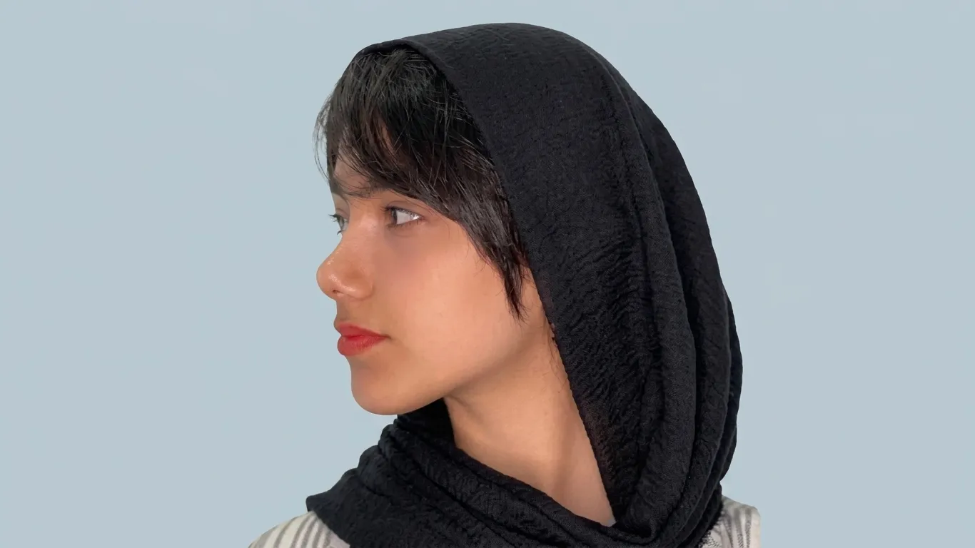 بعد از اصلاح فرم بینی و بهبود تناسب نیم‌رخ 