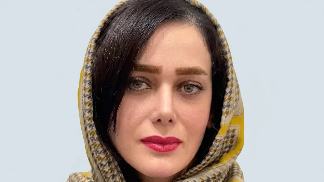 بعد از رینوپلاستی طبیعی و متناسب با چهره